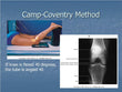Knee Camp Coventry Method X-RAY