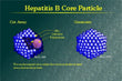 HEPATITIS B CORE IgM (Anti HBc IgM) >