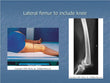 Femur To Knee Lateral X-RAY