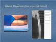 Femur Proximal Lateral X-RAY